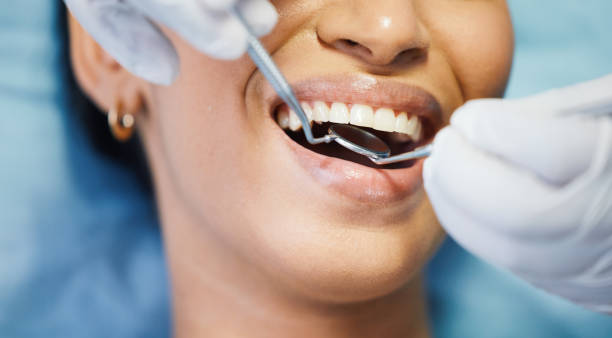 Best Emergency Treatment for Dental Infections or Abscesses in Marlboro Village, MD